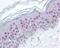 Nucleophosmin 1 antibody, 48-792, ProSci, Immunohistochemistry paraffin image 