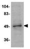 Zinc Finger And BTB Domain Containing 2 antibody, GTX85352, GeneTex, Western Blot image 