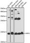 ADP-ribosylation factor 4 antibody, 23-075, ProSci, Western Blot image 