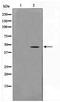 Actin Gamma 2, Smooth Muscle antibody, TA347641, Origene, Western Blot image 