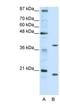 Zinc finger protein 322A antibody, NBP1-80365, Novus Biologicals, Western Blot image 