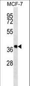 Dehydrogenase/Reductase 7B antibody, LS-C167402, Lifespan Biosciences, Western Blot image 