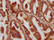 Anti-Mullerian Hormone antibody, LS-C370760, Lifespan Biosciences, Immunohistochemistry paraffin image 