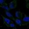 Rho GDP Dissociation Inhibitor Gamma antibody, NBP2-69064, Novus Biologicals, Immunocytochemistry image 