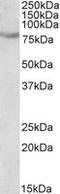 SIM BHLH Transcription Factor 2 antibody, LS-C139715, Lifespan Biosciences, Western Blot image 