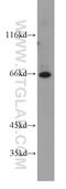 Phosphatidylinositol Glycan Anchor Biosynthesis Class T antibody, 16906-1-AP, Proteintech Group, Western Blot image 