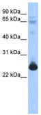 Transcription Elongation Factor A Like 1 antibody, TA343484, Origene, Western Blot image 