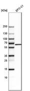 Glutaminase antibody, NBP1-89766, Novus Biologicals, Western Blot image 