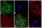 Troponin I1, Slow Skeletal Type antibody, 710580, Invitrogen Antibodies, Immunofluorescence image 