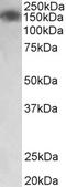 Myosin Light Chain Kinase antibody, LS-C154783, Lifespan Biosciences, Western Blot image 