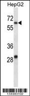 Potassium voltage-gated channel subfamily C member 1 antibody, 57-805, ProSci, Western Blot image 