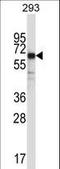 Synaptotagmin 6 antibody, LS-C161655, Lifespan Biosciences, Western Blot image 