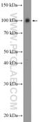 Potassium Voltage-Gated Channel Subfamily C Member 4 antibody, 18092-1-AP, Proteintech Group, Western Blot image 