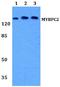 Myosin Binding Protein C, Fast Type antibody, A14099-1, Boster Biological Technology, Western Blot image 