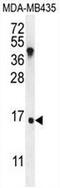 IGKV A18 antibody, AP52172PU-N, Origene, Western Blot image 