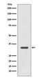 Major Histocompatibility Complex, Class II, DR Alpha antibody, M01195-2, Boster Biological Technology, Western Blot image 