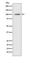 ATPase Sarcoplasmic/Endoplasmic Reticulum Ca2+ Transporting 1 antibody, M04657-1, Boster Biological Technology, Western Blot image 