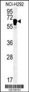 Tetratricopeptide Repeat Domain 26 antibody, 61-881, ProSci, Western Blot image 