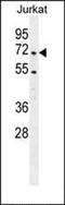 Proopiomelanocortin antibody, orb221342, Biorbyt, Western Blot image 