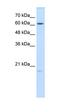 Glutathione Peroxidase 3 antibody, orb330188, Biorbyt, Western Blot image 