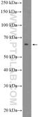 Copine 8 antibody, 20097-1-AP, Proteintech Group, Western Blot image 