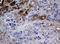 NME/NM23 Nucleoside Diphosphate Kinase 1 antibody, LS-C175587, Lifespan Biosciences, Immunohistochemistry frozen image 