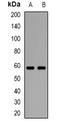 Acid Sensing Ion Channel Subunit 1 antibody, orb382602, Biorbyt, Western Blot image 