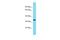 Olfactory receptor 110 antibody, A30192, Boster Biological Technology, Western Blot image 