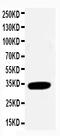 Cyclin Dependent Kinase 2 antibody, PA1547, Boster Biological Technology, Western Blot image 