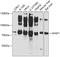 Actin Filament Associated Protein 1 antibody, GTX32427, GeneTex, Western Blot image 