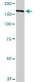 Complement Factor H antibody, H00003075-D01P, Novus Biologicals, Western Blot image 