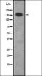 CDC42 Binding Protein Kinase Gamma antibody, orb335223, Biorbyt, Western Blot image 