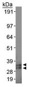 Synaptonemal Complex Protein 3 antibody, GTX15093, GeneTex, Western Blot image 