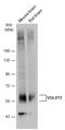 Solute Carrier Family 17 Member 6 antibody, GTX133142, GeneTex, Western Blot image 