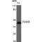 Oxoeicosanoid Receptor 1 antibody, LS-C386393, Lifespan Biosciences, Western Blot image 