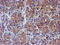Spermine Synthase antibody, M01831, Boster Biological Technology, Immunohistochemistry paraffin image 