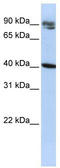 Kelch Domain Containing 8A antibody, TA343873, Origene, Western Blot image 