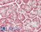 Interleukin 12A antibody, LS-B13953, Lifespan Biosciences, Immunohistochemistry paraffin image 