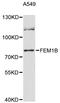 Fem-1 Homolog B antibody, STJ114668, St John