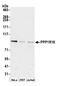 Protein Phosphatase 1 Regulatory Subunit 18 antibody, A305-615A-M, Bethyl Labs, Western Blot image 