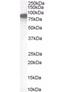 Ezrin antibody, orb19239, Biorbyt, Western Blot image 