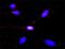 Zinc finger protein GLI3 antibody, H00002737-M01, Novus Biologicals, Proximity Ligation Assay image 