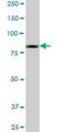 Discs Large MAGUK Scaffold Protein 4 antibody, H00001742-B01P, Novus Biologicals, Western Blot image 