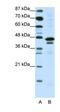 Cytosolic Iron-Sulfur Assembly Component 1 antibody, orb324759, Biorbyt, Western Blot image 