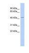 Thymopoietin antibody, NBP1-59403, Novus Biologicals, Western Blot image 