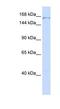 PDS5 Cohesin Associated Factor A antibody, NBP1-57664, Novus Biologicals, Western Blot image 