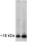 Aph-1 Homolog A, Gamma-Secretase Subunit antibody, GTX79306, GeneTex, Western Blot image 