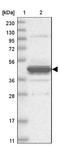 Epoxide Hydrolase 4 antibody, NBP1-89307, Novus Biologicals, Western Blot image 