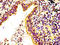 Ribosomal Protein S6 Kinase A6 antibody, LS-C673768, Lifespan Biosciences, Immunohistochemistry paraffin image 