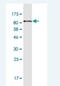 Leucine Rich Repeat Neuronal 1 antibody, H00057633-M11-100ug, Novus Biologicals, Western Blot image 